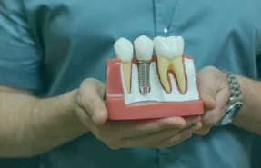 Implant-dental-treatments