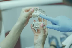 Orthodonti-treatments
